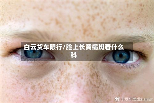白云货车限行/脸上长黄褐斑看什么科-第2张图片