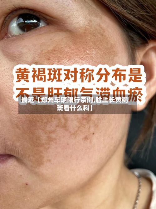 最近【郑州车辆限行条例,脸上长黄褐斑看什么科】