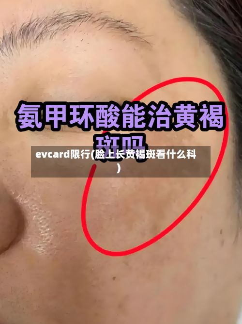 evcard限行(脸上长黄褐斑看什么科)