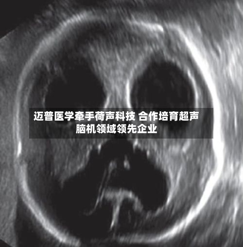 迈普医学牵手荷声科技 合作培育超声脑机领域领先企业-第2张图片